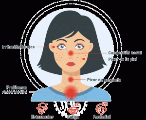 Síntomas de la alergia